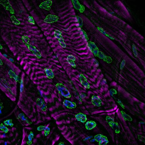 Image of drosophila larval body with staining